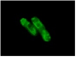 TP45-GFP.jpg